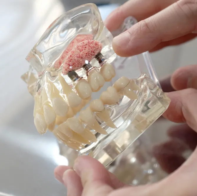 Dental Implants in Eagan, MN