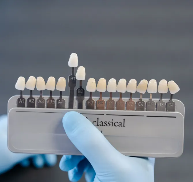 Dental Veneers in Eagan, MN